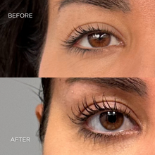 Load image into Gallery viewer, SkinMedica Latisse 5mL