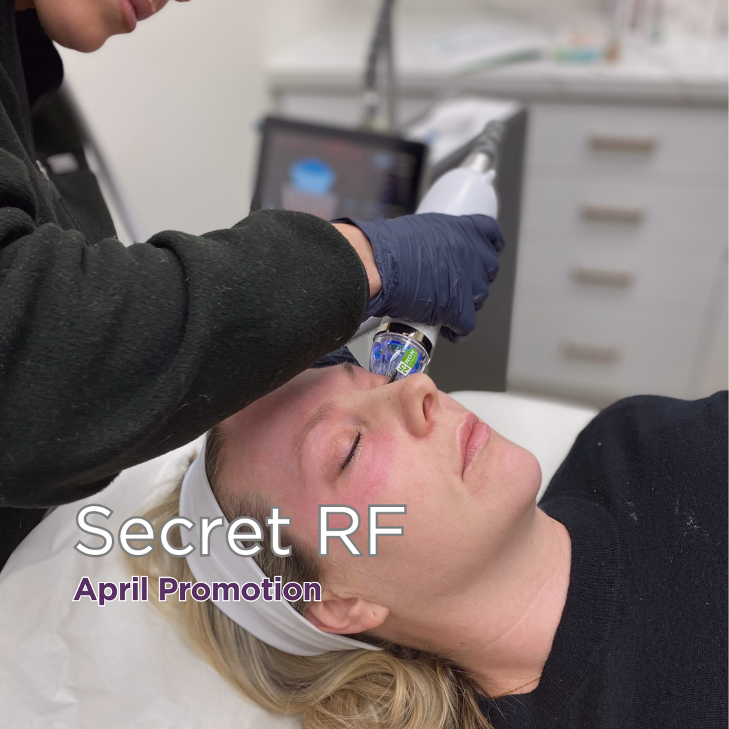 20% Off Secret RF (X3) - Save $500!